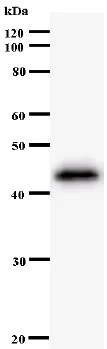 Western blot - Anti-ZNF384 antibody [3545C5a] (AB54360)