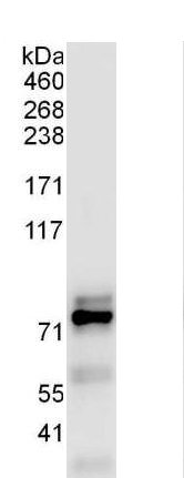 Immunoprecipitation - Anti-ZNF384 antibody (AB176689), expandable thumbnail