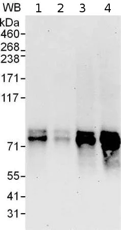 Western blot - Anti-ZNF384 antibody (AB176689)