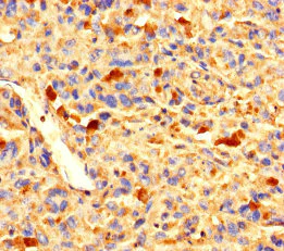 Immunohistochemistry (Formalin/PFA-fixed paraffin-embedded sections) - Anti-ZNF384 antibody (AB235773)