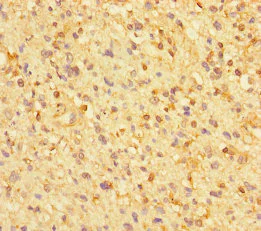 Immunohistochemistry (Formalin/PFA-fixed paraffin-embedded sections) - Anti-ZNF384 antibody (AB235773)