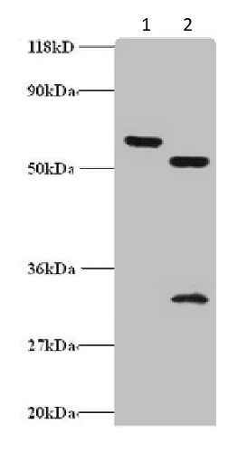 Western blot - Anti-ZNF384 antibody (AB235773)