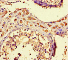 Immunohistochemistry (Formalin/PFA-fixed paraffin-embedded sections) - Anti-ZNF408 antibody (AB222803)