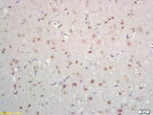 Immunohistochemistry (Formalin/PFA-fixed paraffin-embedded sections) - Anti-ZNF423 antibody (AB216970)