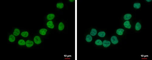 Immunocytochemistry/ Immunofluorescence - Anti-ZNF45 antibody (AB228574)