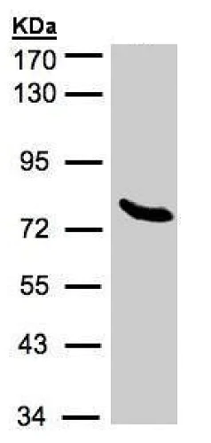 Western blot - Anti-ZNF45 antibody (AB228574)
