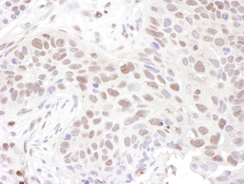 Immunohistochemistry (Formalin/PFA-fixed paraffin-embedded sections) - Anti-ZNF462 antibody (AB117771)