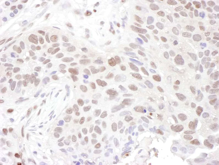 Immunohistochemistry (Formalin/PFA-fixed paraffin-embedded sections) - Anti-ZNF462 antibody (AB117771)