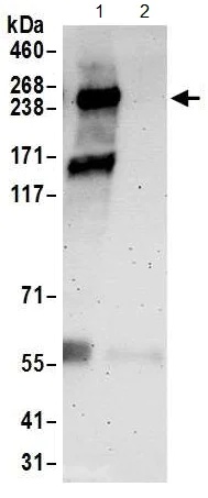 Immunoprecipitation - Anti-ZNF462 antibody (AB117771)