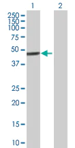 Western blot - Anti-ZNF468 antibody (AB88862)