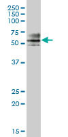 Western blot - Anti-ZNF468 antibody (AB88862)