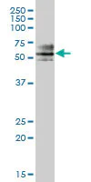 Western blot - Anti-ZNF468 antibody (AB88862)