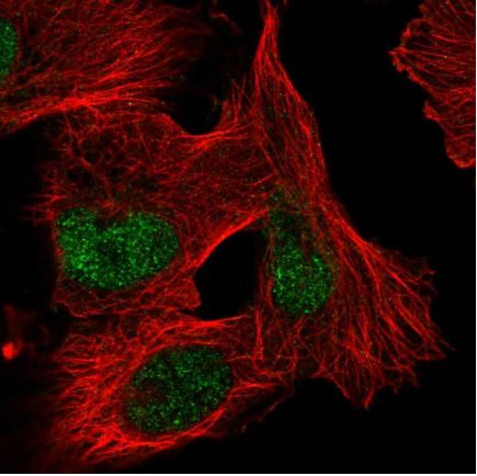 Immunocytochemistry/ Immunofluorescence - Anti-ZNF471/ERP1 antibody (AB204974)