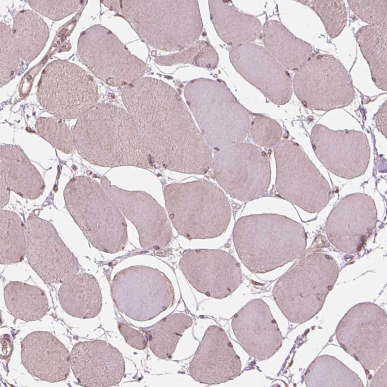Immunohistochemistry (Formalin/PFA-fixed paraffin-embedded sections) - Anti-ZNF471/ERP1 antibody (AB204974)