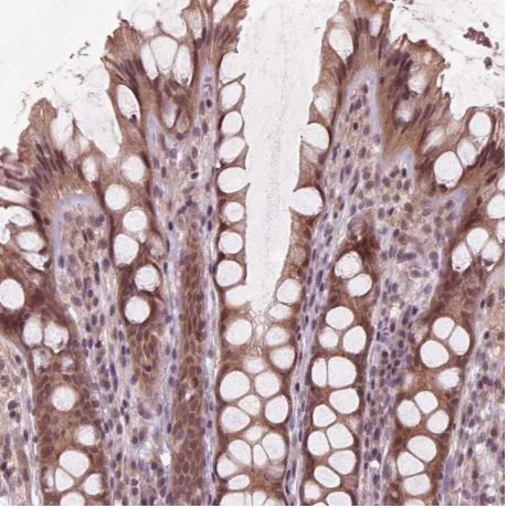 Immunohistochemistry (Formalin/PFA-fixed paraffin-embedded sections) - Anti-ZNF471/ERP1 antibody (AB204974)
