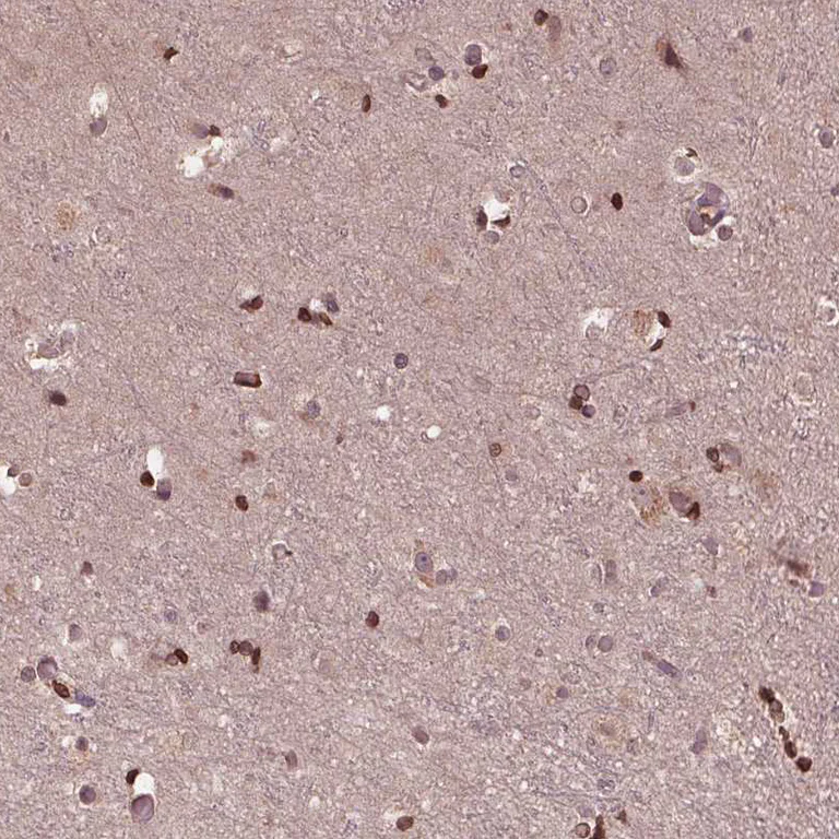 Immunohistochemistry (Formalin/PFA-fixed paraffin-embedded sections) - Anti-ZNF471/ERP1 antibody (AB204974)