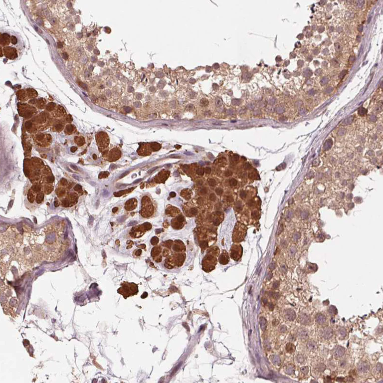 Immunohistochemistry (Formalin/PFA-fixed paraffin-embedded sections) - Anti-ZNF471/ERP1 antibody (AB204974)