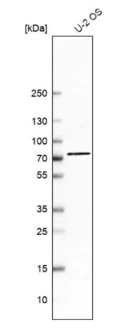 Western blot - Anti-ZNF471/ERP1 antibody (AB204974)