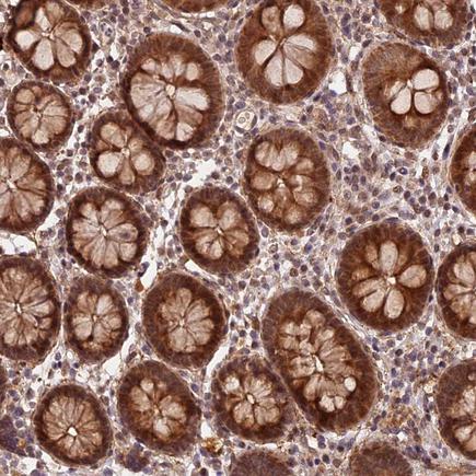 Immunohistochemistry (Formalin/PFA-fixed paraffin-embedded sections) - Anti-ZNF480 antibody (AB243700)