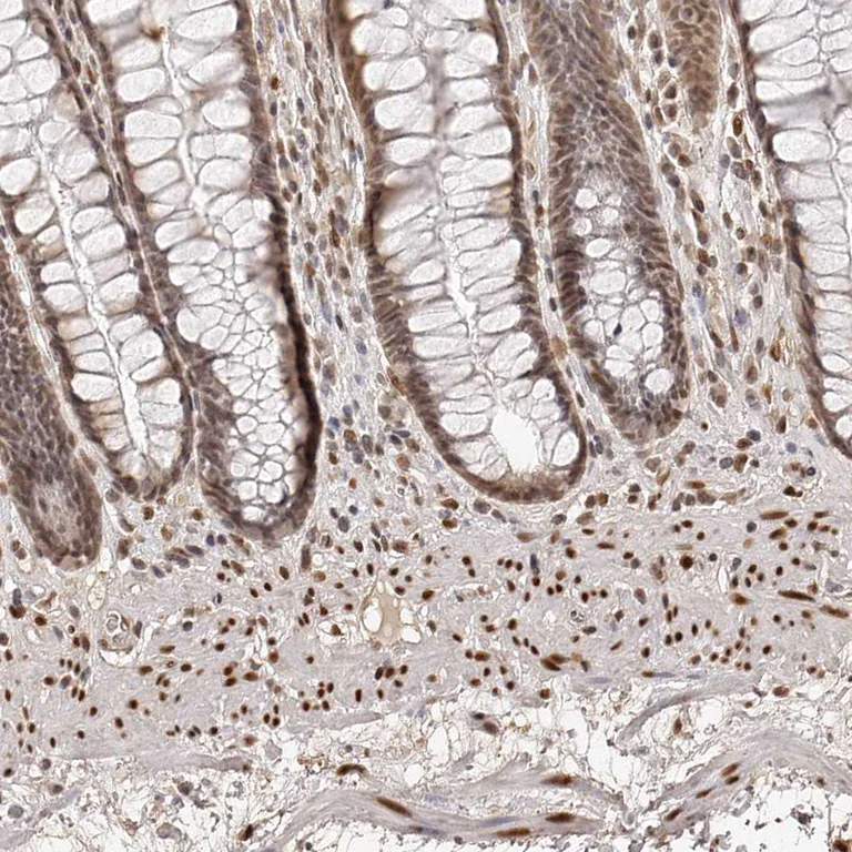 Immunohistochemistry (Formalin/PFA-fixed paraffin-embedded sections) - Anti-ZNF503 antibody (AB254715)