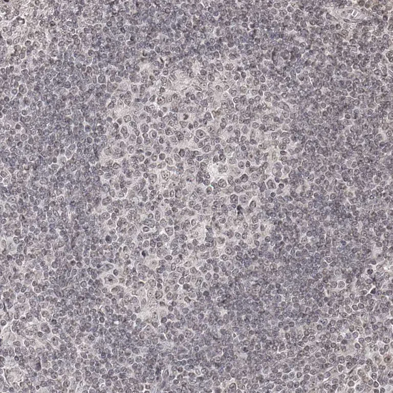 Immunohistochemistry (Formalin/PFA-fixed paraffin-embedded sections) - Anti-ZNF503 antibody (AB254715)