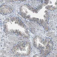 Immunohistochemistry (Formalin/PFA-fixed paraffin-embedded sections) - Anti-ZNF516 antibody (AB121486)