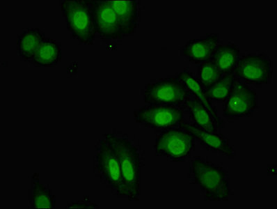 Immunocytochemistry/ Immunofluorescence - Anti-ZNF529 antibody (AB237486)