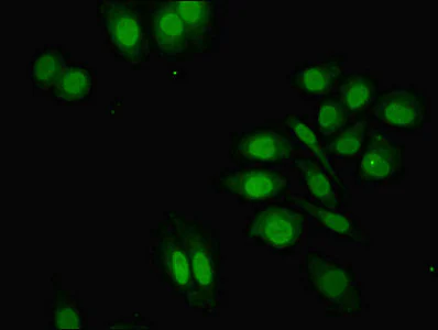 Immunocytochemistry/ Immunofluorescence - Anti-ZNF529 antibody (AB237486)