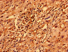 Immunohistochemistry (Formalin/PFA-fixed paraffin-embedded sections) - Anti-ZNF529 antibody (AB237486)