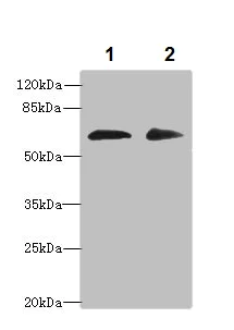 Western blot - Anti-ZNF529 antibody (AB237486)