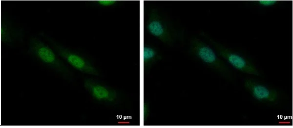 Immunocytochemistry/ Immunofluorescence - Anti-ZNF545 antibody (AB228946)