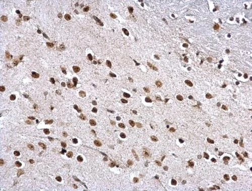 Immunohistochemistry (Formalin/PFA-fixed paraffin-embedded sections) - Anti-ZNF545 antibody (AB228946)
