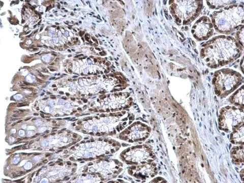 Immunohistochemistry (Formalin/PFA-fixed paraffin-embedded sections) - Anti-ZNF545 antibody (AB228946)