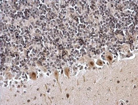 Immunohistochemistry (Formalin/PFA-fixed paraffin-embedded sections) - Anti-ZNF545 antibody (AB228946)