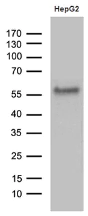 Western blot - Anti-ZNF545 antibody [OTI5D8] (AB279394)