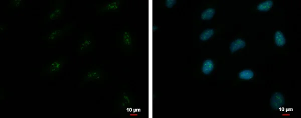 Immunocytochemistry/ Immunofluorescence - Anti-ZNF556 antibody (AB228833)