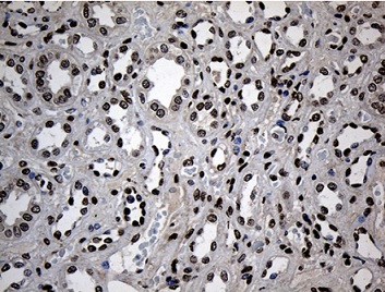 Immunohistochemistry (Formalin/PFA-fixed paraffin-embedded sections) - Anti-ZNF558 antibody [OTI2C4] (AB236428)