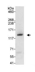 Immunoprecipitation - Anti-ZNF574 antibody (AB85933)