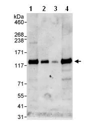 Western blot - Anti-ZNF574 antibody (AB85933)