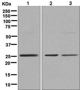 Western blot - Anti-ZNF575 antibody [EPR9027] - BSA and Azide free (AB248850), expandable thumbnail