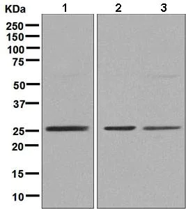 Western blot - Anti-ZNF575 antibody [EPR9027] - BSA and Azide free (AB248850)