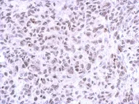 Immunohistochemistry (Formalin/PFA-fixed paraffin-embedded sections) - Anti-ZNF587 antibody (AB111697)