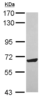 Western blot - Anti-ZNF587 antibody (AB111697)