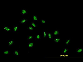 Immunocytochemistry/ Immunofluorescence - Anti-ZNF593 antibody (AB169079)