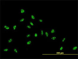 Immunocytochemistry/ Immunofluorescence - Anti-ZNF593 antibody (AB169079)