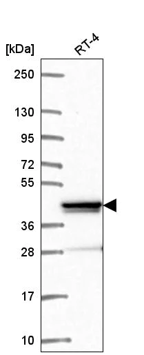 Western blot - Anti-ZNF618 antibody (AB272674)