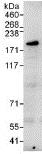 Immunoprecipitation - Anti-ZNF644 antibody (AB117777), expandable thumbnail