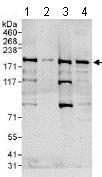 Western blot - Anti-ZNF644 antibody (AB117777), expandable thumbnail