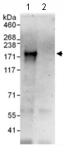 Immunoprecipitation - Anti-ZNF687 antibody (AB117803), expandable thumbnail