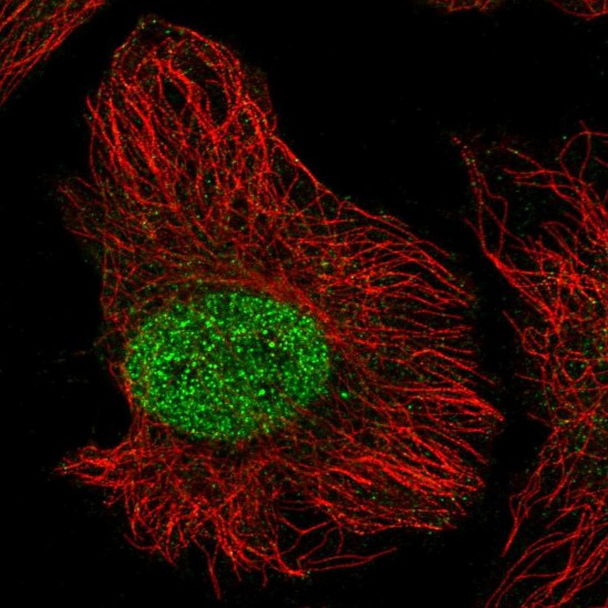 Immunocytochemistry/ Immunofluorescence - Anti-ZNF692 antibody (AB204595), expandable thumbnail